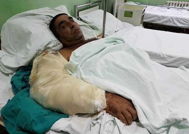 ВЕЛИКИ ПОДВИГ НИШКИХ ЛЕКАРА: Спасли две руке у три дана