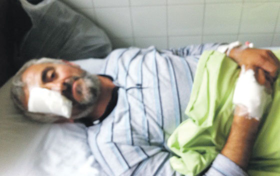 Отео, па брутално претукао столара