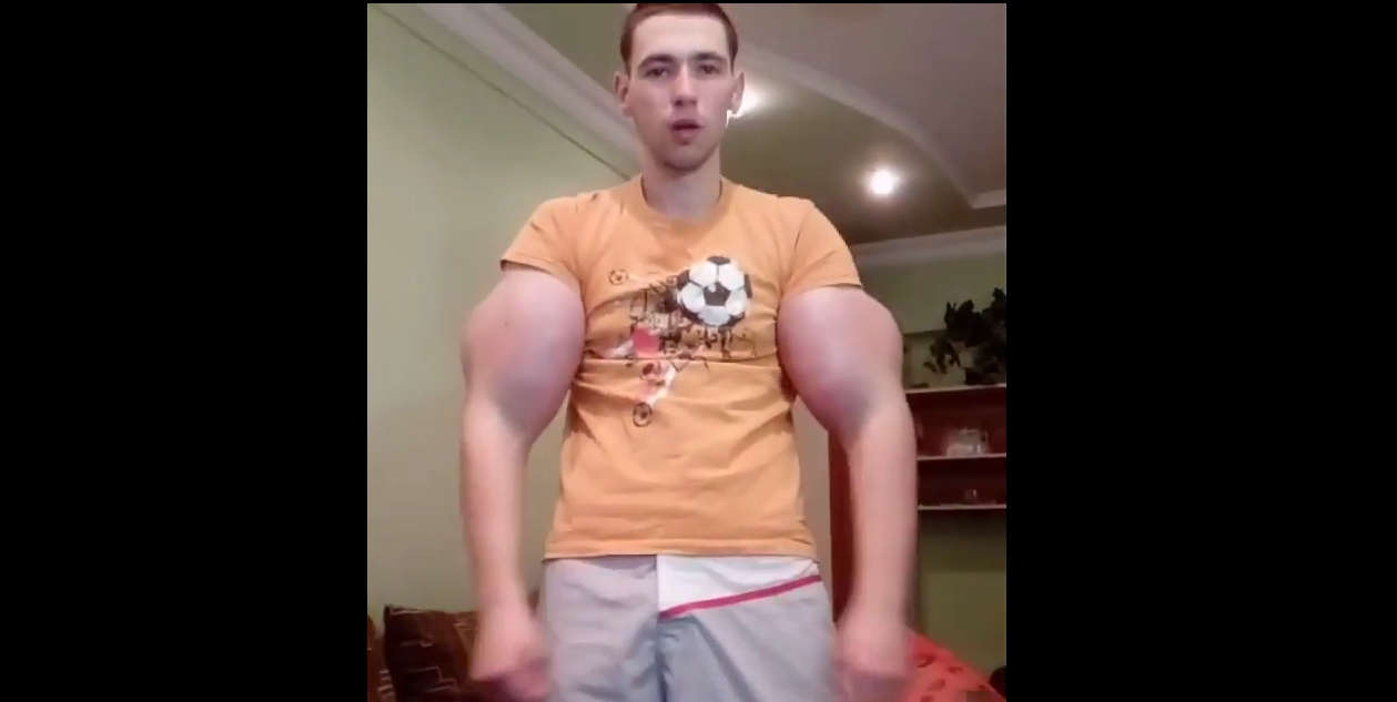 РИЗИКУЈЕ ДА ОСТАНЕ ПАРАЛИЗОВАН: Младић убризгава уље у мишиће како би били што већи