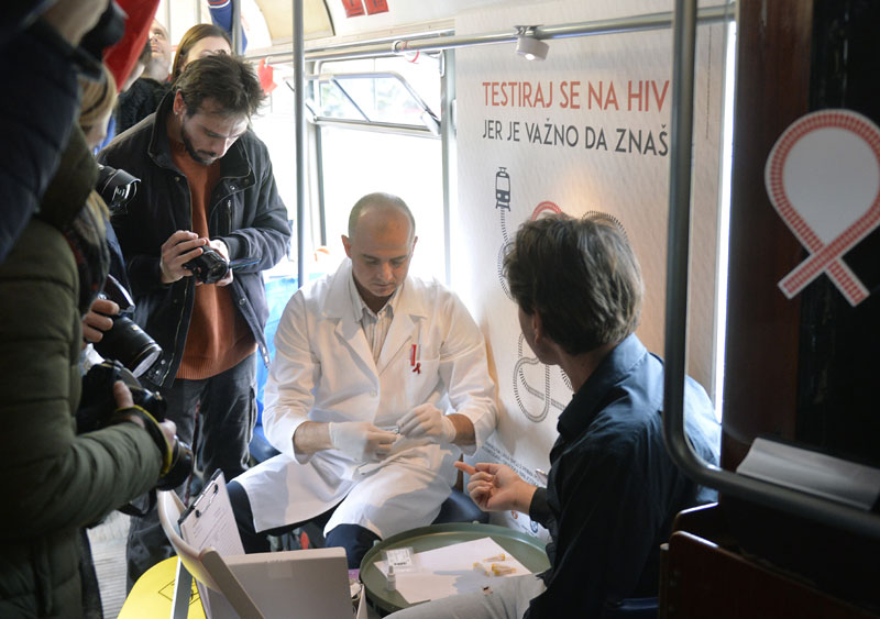 ХИВ мање напада