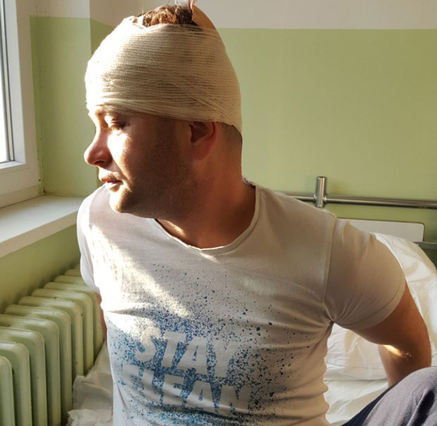 ЈЕДВА ЖИВУ ГЛАВУ ИЗВУКАО: Нишлија зверски претучен у породичној кући (ФОТО)