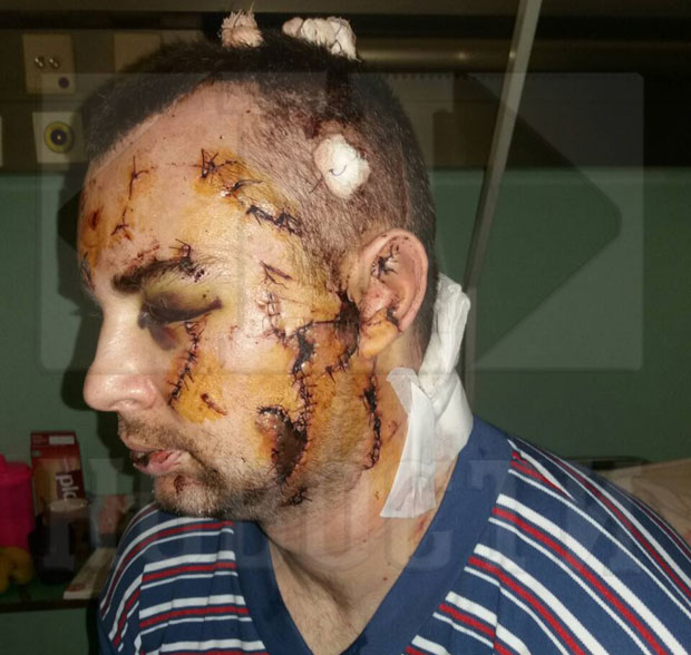 УЗНЕМИРУЈУЋЕ: Погледајте како су криминалци унаказили полицајца из Сремске Митровице (ФОТО)