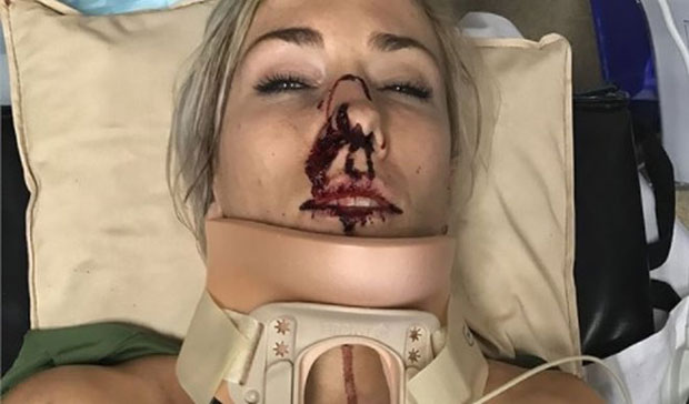 СТРАВИЧНА НЕСРЕЋА: Двострука олимпијска шампионка у језивом стању