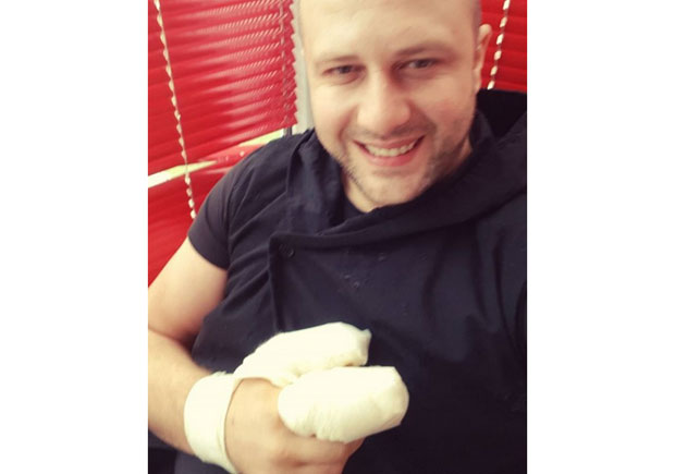 ЈЕДВА ГА УШИЛИ: Дадо Полумента разнео себи прсте петардом