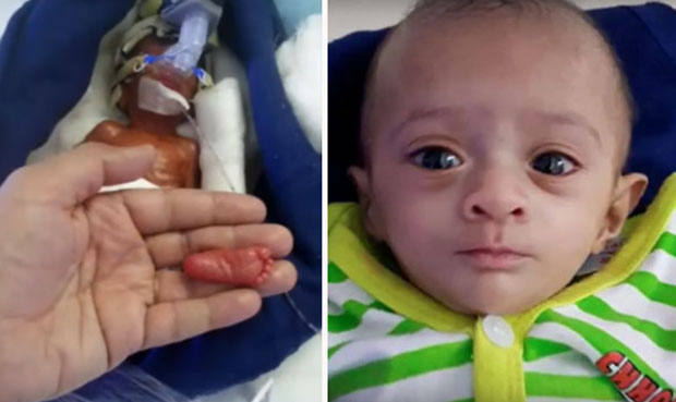 Мануши, беба која је тежила 400 грама, изборила се за живот (ФОТО+ВИДЕО)