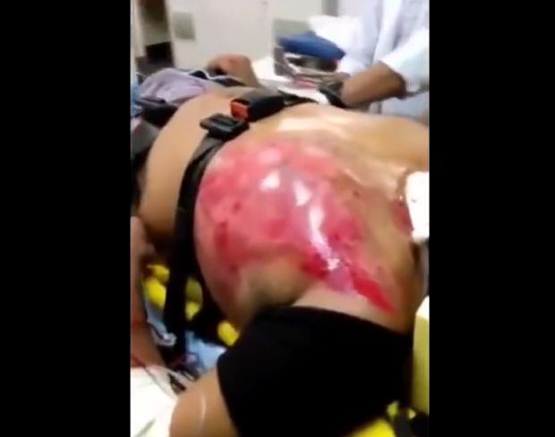 ДОКТОРИ ШОКИРАНИ: Младић попио 24 енергетска пића (ВИДЕО)