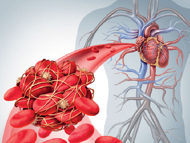 На хладноћи прети гангрена