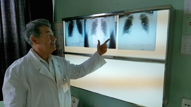 Рак плућа - за аларм