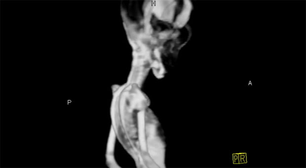 РЕШЕНА МИСТЕРИЈА: Нагађали да је ”ванземаљац” па коначно открили праву истину (ВИДЕО)