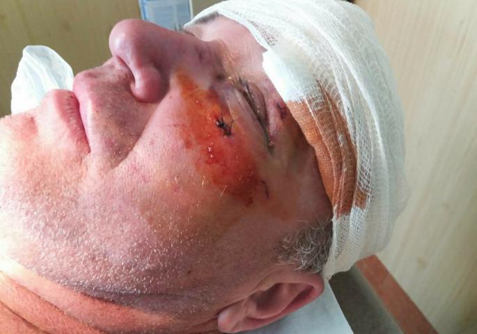 СНС: У Водицама код Смедеревске Паланке претучен члан СНС