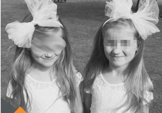 МИСТЕРИЈА ДВЕ БЛИЗНАКИЊЕ: Имале исте симптоме тумора, а онда су се сви шокирали