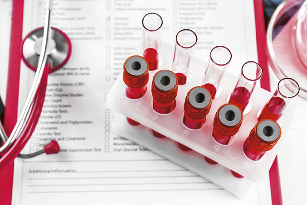 Иза пролећног умора често се крије анемија