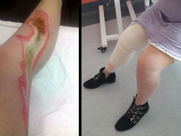 Нога страдала пред завршетак операције жучи!