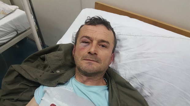 У Пријепољу брутално претучен таксиста, нападачима одређен притвор