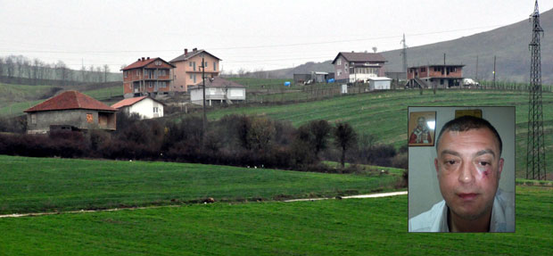 ИСПОВЕСТ СРБИНА ИЗ КОСОВСКЕ МИТРОВИЦЕ: Албанци ме шутирали пред децом