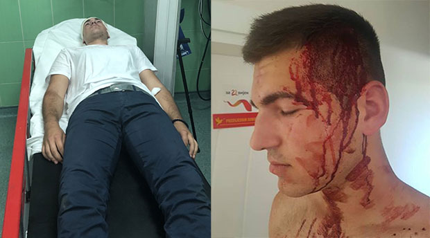 КРВАВЕ ГЛАВЕ У ПОДГОРИЦИ: Локалне изборе обележили туче и напади на одборнике (ВИДЕО)