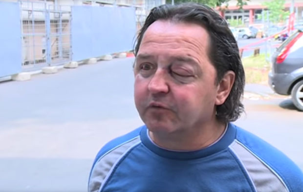 ОВАКО ИЗГЛЕДА ПРЕТУЧЕНИ БОЖИДАР МИЛИЋ: Тукли су ме и украли ми паре само зато што сам се побунио! (ВИДЕО)