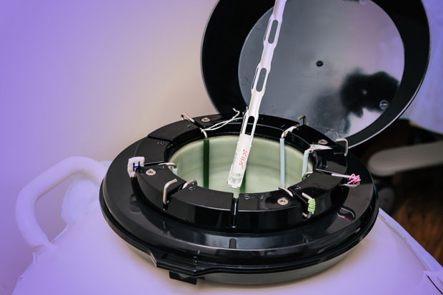 Од 15. јуна замрзавање ембриона о трошку државе