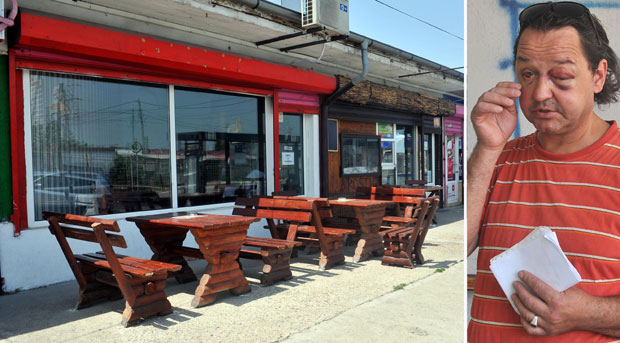 БОЖИДАР МИЛИЋ НАКОН ТУЧЕ: После напада батинаша мора на две операције