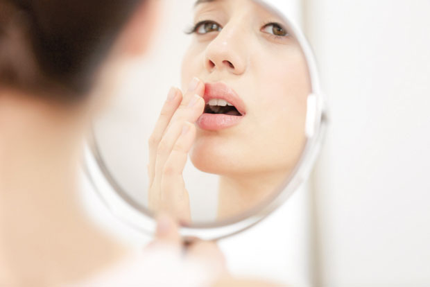 Херпес не смете прикривати шминком