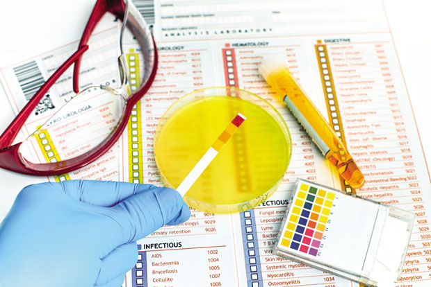 Најтеже је ако упала захвати и бубреге