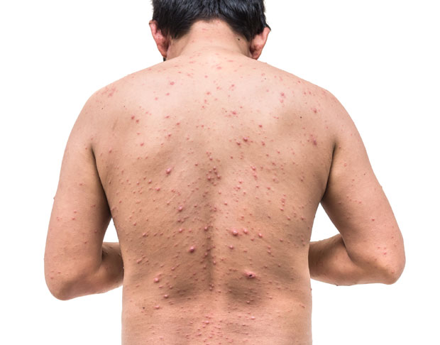 МАЛЕ БОГИЊЕ У ФАБРИЦИ: За две недеље оболело 55