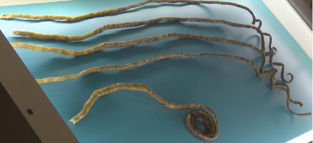 ЗАПАЊУЈУЋЕ И ОДВРАТНО: Брусилицом одсекао нокте после 66 година (ВИДЕО)