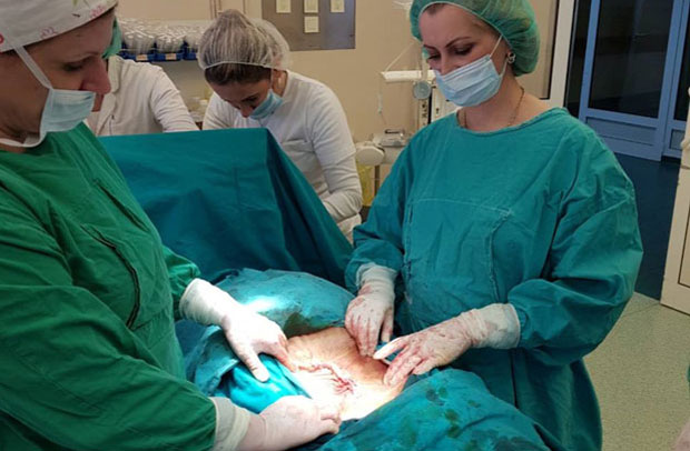 КОМПЛИКОВАН ЗАХВАТ У КРУШЕВАЧКОЈ БОЛНИЦИ: Оперисали жени тумор тежак 30 килограма (ФОТО)