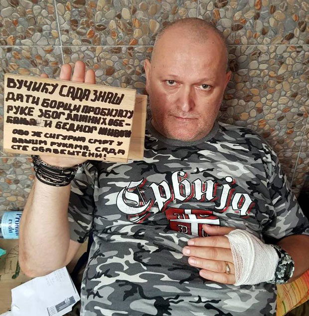 ШТРАЈК РЕЗЕРВИСТА У ВАЉЕВУ: Брадић ексером пробио и десну шаку!