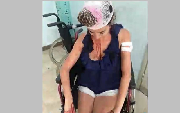 УЖАС У СПЛИТУ: Британка претучена металном шипком због цене смештаја (ВИДЕО)