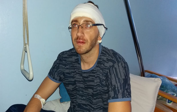 НАПАД НА НОВИНАРА: Шипкама га тукли по глави