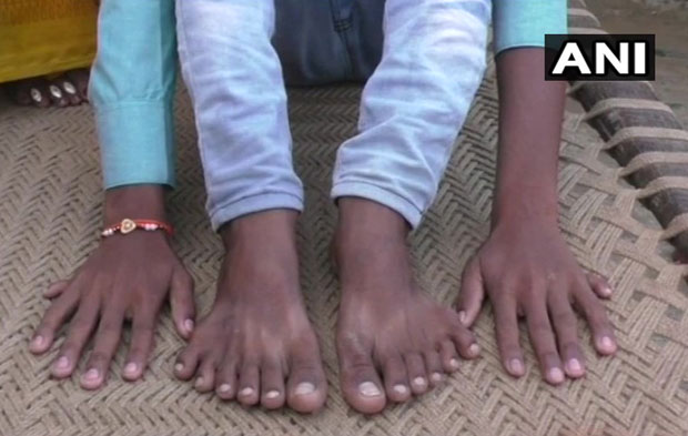 Рођаци желе да жртвују дечака са 24 прста по савету “чаробњака”