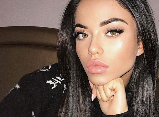 Шпанска мисица повређена у експлозији кола у Земуну објавила фотографије и упутила снажну поруку! (ФОТО)