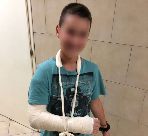 БРУТАЛАН НАПАД БЛИЗУ ШКОЛЕ: Кинез лупао главу дечака о металну ограду