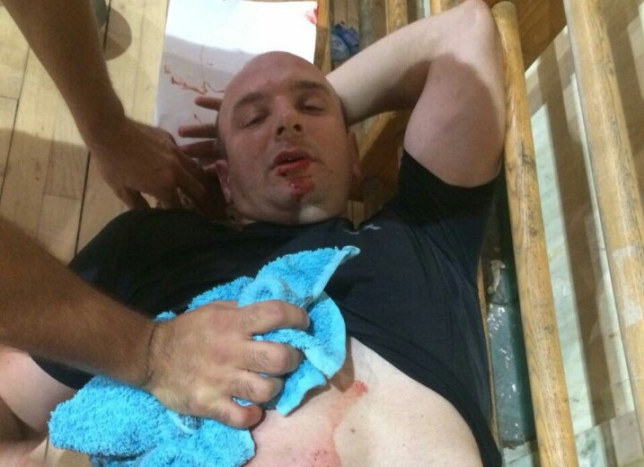 НАПАД У АЛЕКСИНЦУ: Председник клуба избоден пред рукометашицама