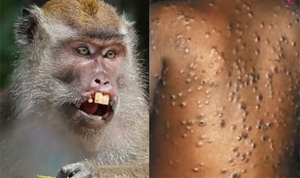 УЗБУНА ЗБОГ “МАЈМУНСКИХ БОГИЊА: Појачана контрола граница, опрез за путнике у Нигерију!