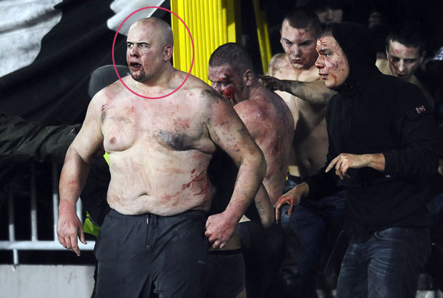 ЈЕЗИВА СМРТ: Погинуо Хрват који је учествовао у нередима на дербију, прегазила га три аутомобила!