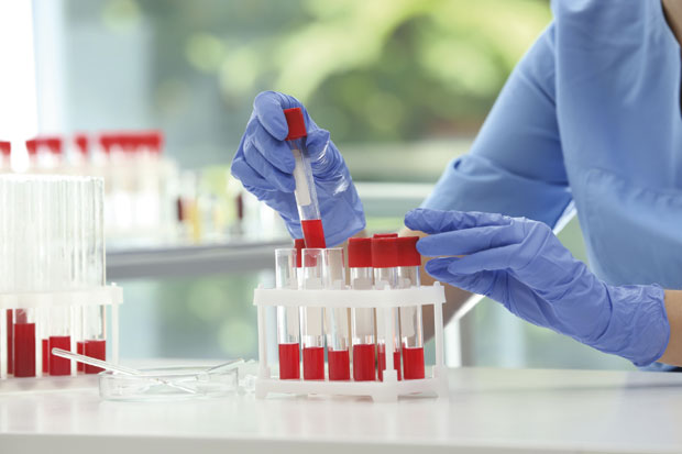 Због терапије против тромба чешће на анализу крви