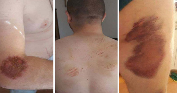 МУП И ТУЖИЛАШТВО НЕМИ НА ОПТУЖБЕ: Србе ударали ногама и палицама, клештима им гњечили тестисе, ножем резали уши!