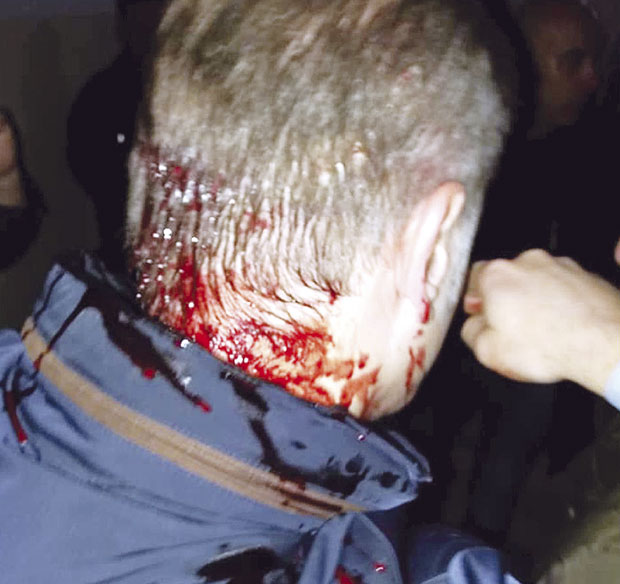 Министар Стефановић: Бесмислено да Гашић има везе са нападом на Борка Стефановића