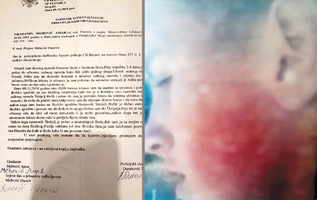 ПОСЛЕ ИНЦИДЕНТА У ОШ САВИН БОР: Шамарање ђака без санкција?