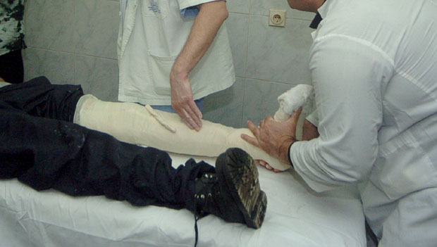 БИЈЕЉИНСКИМ ЛЕКАРИМА ПУНЕ РУКЕ ПОСЛА: За 24 сата 10 ломова на леду