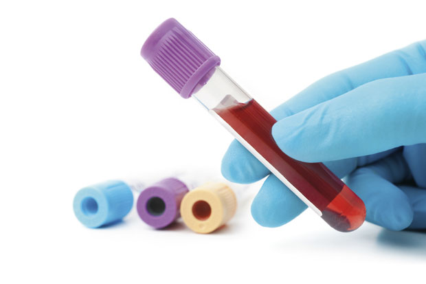 Брзи тест на све карциноме