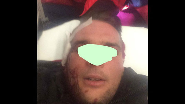 Србин на Крку прво рањен, па кажњен?!
