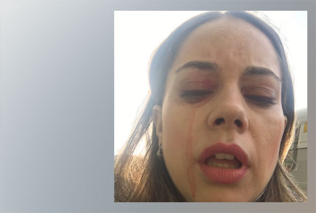 ТУЧА ЗБОГ УЛАСКА У АУТОБУС: 82-годишњак ударао девојку у главу и тело