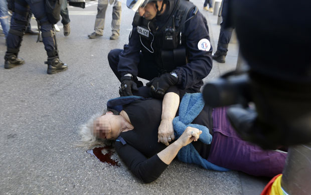 БРУТАЛНОСТ ФРАНЦУСКЕ ПОЛИЦИЈЕ: 73-годишњој активисткињи Жутих прслука разбијена глава