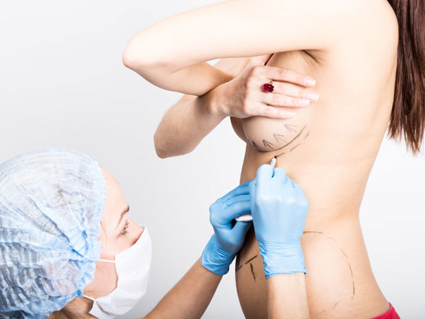 Најчешћа питања за доктора о повећању груди