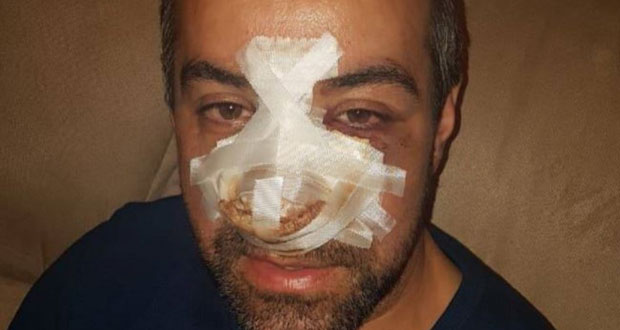 ТОМКИЋУ ЗАПАЉЕНА ПРОДАВНИЦА: После пребијања, претњи и доделе полицијске заштите нови инцидент у Беранама (ФОТО)