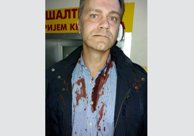 НАПАД НА БОРКА СТЕФАНОВИЋА: Оптужница против три особе