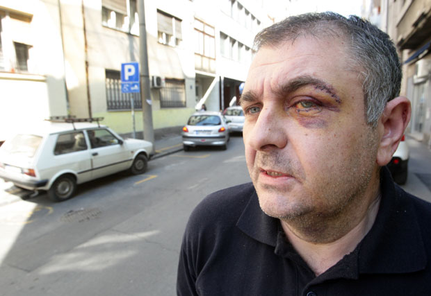 ТУЧА ЗБОГ ПАРКИНГА: Притвор за оца и сина